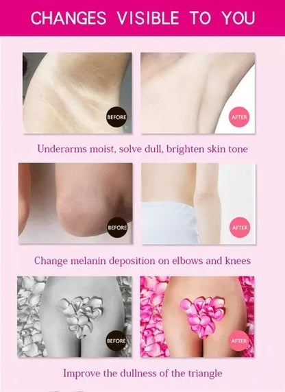 Crema Blanqueadora Aclarante Piel y Más ✨-STK-138