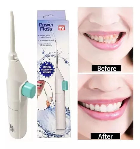 Irrigador Bucal A Presión 🦷💦-STK-801